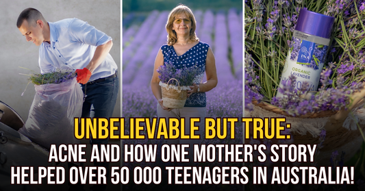 ACNE and how one mother's story helped over 50 000+ teenagers in Australia!