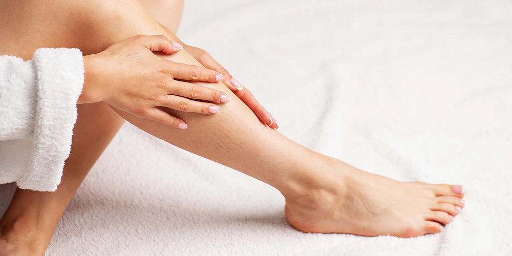 Varicose Veins - Everything You Need To Know