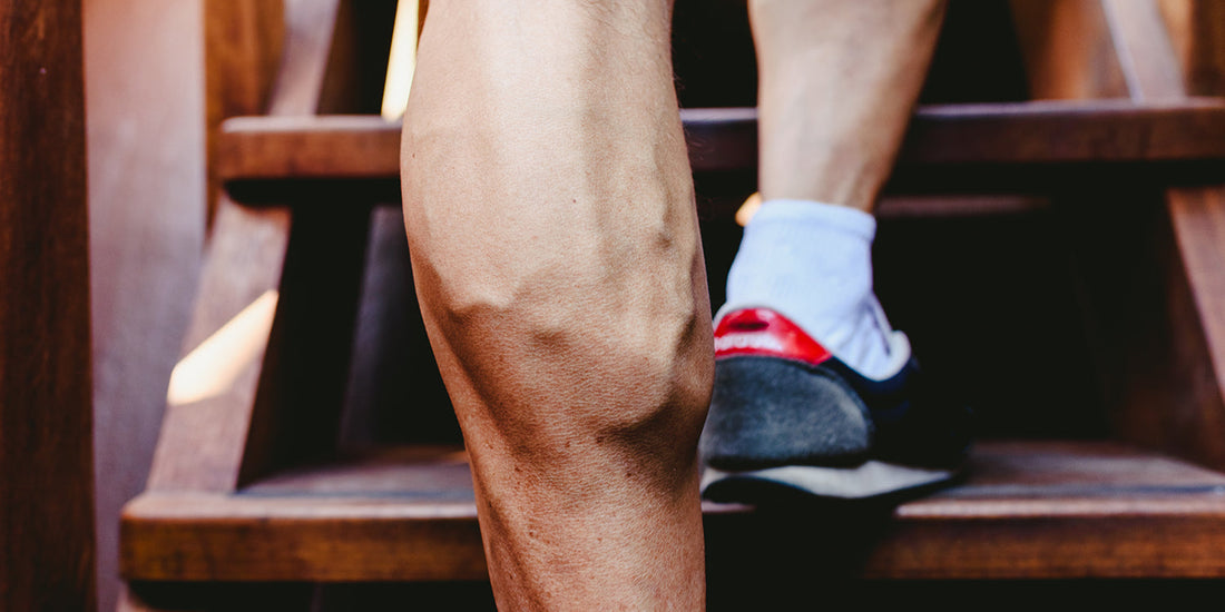 Varicose Veins and Fitness – How to Prevent Them