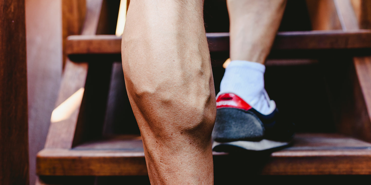 Varicose Veins and Fitness – How to Prevent Them